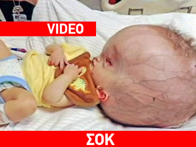 Μάχη να κρατηθεί στη ζωή δίνει βρέφος 11 μηνών